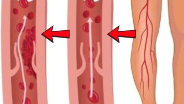 Blood Sugar Diabetes Health Benefits Herbal Remedies India Neem Traditional Medicine 