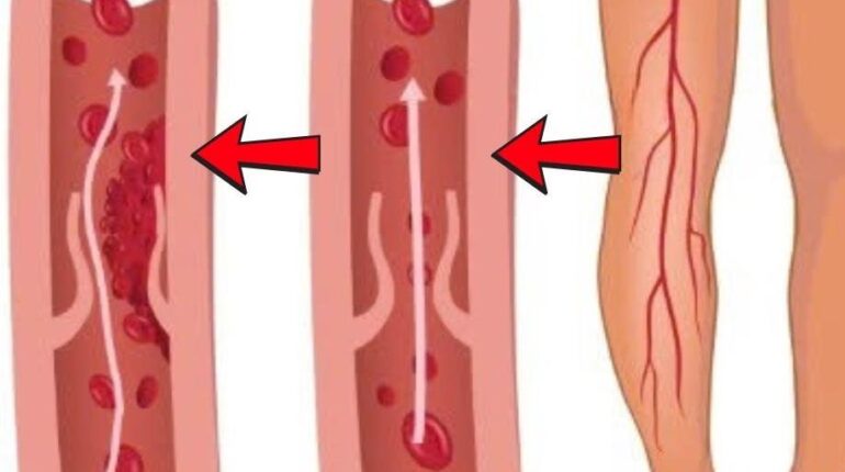 Blood Sugar Diabetes Health Benefits Herbal Remedies India Neem Traditional Medicine 