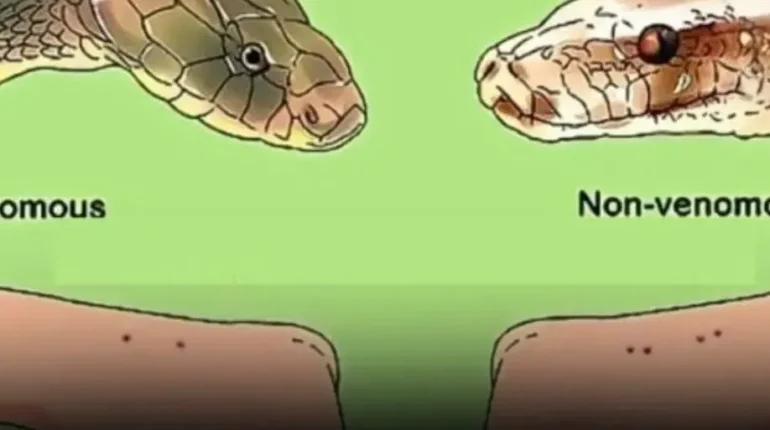 Australia First Aid Medical Emergency Safety Tips Snake Bites Venomous Snakes Wildlife Safety 