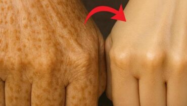Das Geheimnis strahlender Haut, das Dermatologen nicht wollen, dass Sie es wissen: « Es ist bereits in Ihrem Kühlschrank… » Das Geheimnis strahlender Haut, das Dermatologen nicht wollen, dass Sie es wissen: « Es ist bereits in Ihrem Kühlschrank… »