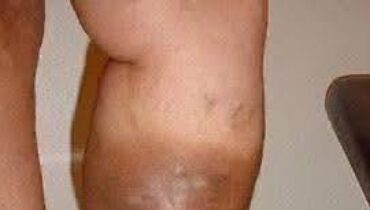 Bladder Health Body Signals Brain Fog Chronic Fatigue Daily Wellness Sleep Aid 