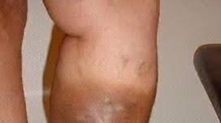 Bladder Health Body Signals Brain Fog Chronic Fatigue Daily Wellness Sleep Aid 