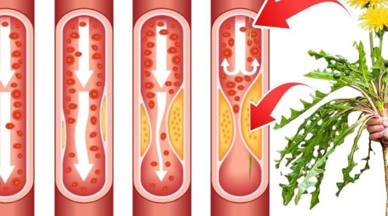 Bloating Relief Dandelion Root Digestion Herbal Tea Liver Function Natural Remedies 