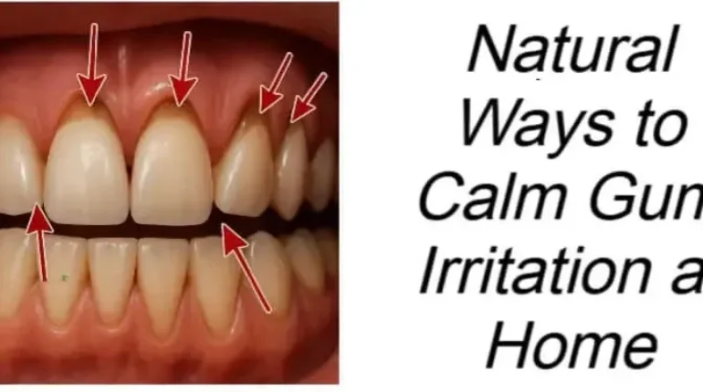 Dental Care gum disease Gum Health Home Remedies Natural Remedies Oral Hygiene 