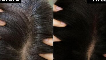 Alte ayurvedische Haarmaske stellt natürliche Haarfarbe bei 73% der Benutzer wieder her: Wie vier einfache Zutaten ruhende Pigmentzellen reaktivieren Alte ayurvedische Haarmaske stellt natürliche Haarfarbe bei 73% der Benutzer wieder her: Wie vier einfache Zutaten ruhende Pigmentzellen reaktivieren