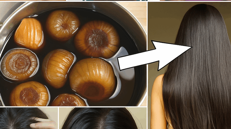 Hair Growth Hair Strength Natural Hair Care Natural Remedies Onion Oil Scalp Health 