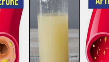 Dieses Morgengetränk, das Ihre Arterien verändern könnte – Was Ärzte Ihnen über diese 3 Zutaten nicht erzählen werden