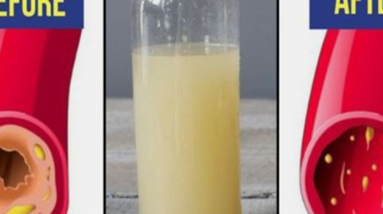 Cardiovascular Health Garlic Ginger Healthy Drinks Heart Health Lemon Natural Remedies 