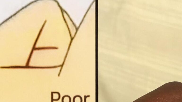 Destiny Hand Reading Palmistry Personal Growth Pseudoscience Symbolism Wealth 