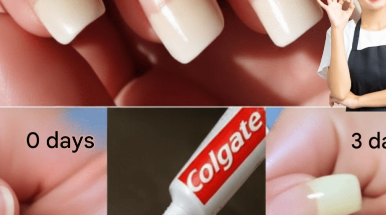 Beauty Tips DIY Beauty Home Remedies Nail Care Nail Shine Nail Strength 