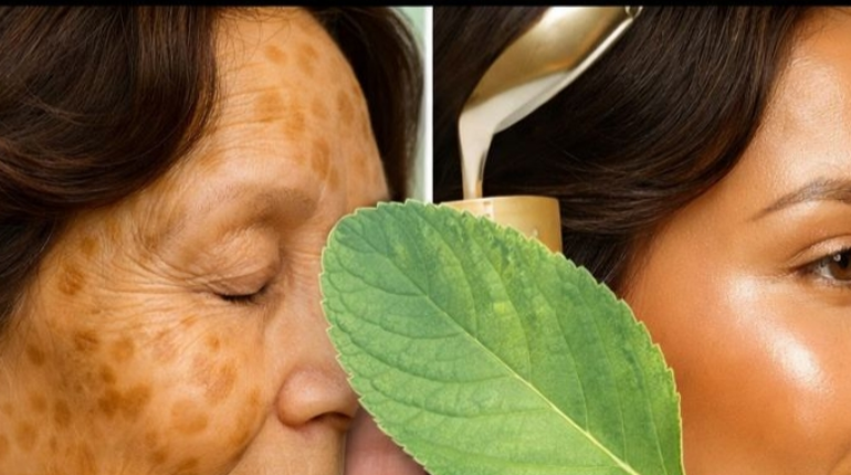 Elasticity Natural Skincare Pigmentation Plant Remedies Skin Aging Traditional Medicine 
