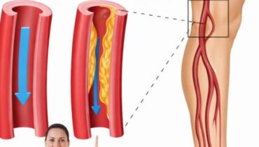Neem-Blätter: Wie diese antike Pflanze den Blutzuckerspiegel, den Kreislauf und die Entzündungskontrolle unterstützt Neem-Blätter: Wie diese antike Pflanze den Blutzuckerspiegel, den Kreislauf und die Entzündungskontrolle unterstützt