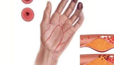 Neemblätter: Wie diese alte Ayurveda-Pflanze natürlich den Blutzucker, die Zirkulation und den Gelenkkomfort unterstützt Neemblätter: Wie diese alte Ayurveda-Pflanze natürlich den Blutzucker, die Zirkulation und den Gelenkkomfort unterstützt