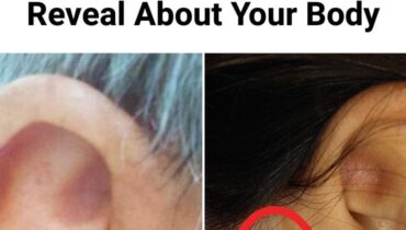 6 Ohrsymptome, die Ihr Arzt möchte, dass Sie aufhören zu ignorieren (das 5. verrät etwas über Ihr Herz)