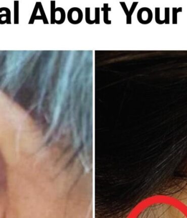 6 Ohrsymptome, die Ihr Arzt möchte, dass Sie aufhören zu ignorieren (das 5. verrät etwas über Ihr Herz)