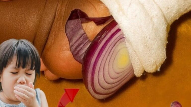 Congestion Relief Cough Relief Home Remedies Natural Health Quercetin Sleep Aid Sulfur Compounds 