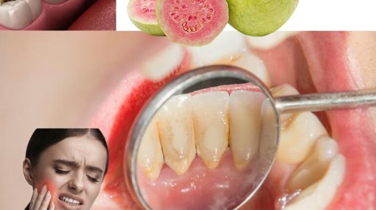 Dental Care Guava Leaves Herbal Medicine Home Remedies Natural Remedies Oral Health 