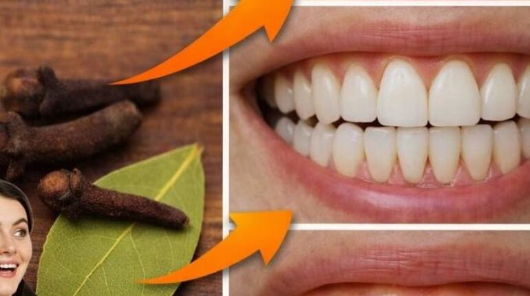 Dental Health gum disease Natural Remedies Oral Hygiene Tartar Removal Teeth Whitening 