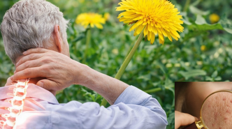 Blood Sugar Dandelion Root Detoxification Digestion Herbal Remedies Liver Health Natural Health 