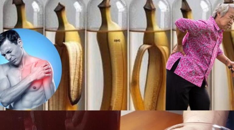 Banana Peels Detox Home Care Natural Hair Care Natural Remedies Plant Fertilizer Skin Care 