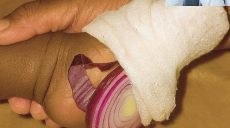 Congestion Relief Cough Relief Home Remedies Natural Remedies Respiratory Health Sleep Aid 