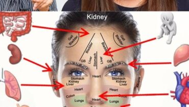18 Gesichtssignale, die ernsthafte Gesundheitsprobleme verraten: von Lebererkrankungen bis zu Herzproblemen 18 Gesichtssignale, die ernsthafte Gesundheitsprobleme verraten: von Lebererkrankungen bis zu Herzproblemen