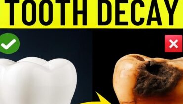 Im Alter von 47 entdecken Zahnärzte, was sie dreimal pro Woche mit Guavablättern tut Im Alter von 47 entdecken Zahnärzte, was sie dreimal pro Woche mit Guavablättern tut