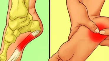 Plantarfasziitis: 7 tägliche Übungen, die Fersenschmerzen ohne ärztliche Intervention lindern Plantarfasziitis: 7 tägliche Übungen, die Fersenschmerzen ohne ärztliche Intervention lindern