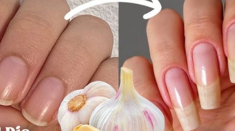 Beauty Tips DIY Beauty Garlic Hair and Nails Nail Care Nail Growth Natural Remedies 