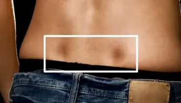 Bladder Health Body Chills Circulation Fitness Genetics Lower Back Venus Dimples 