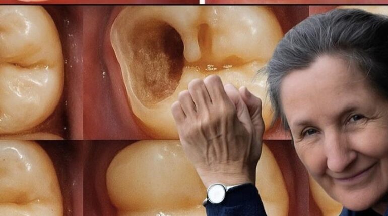 Cavity Prevention Diet Changes Mineral-Rich Foods Natural Health Oral Hygiene Tooth Enamel 