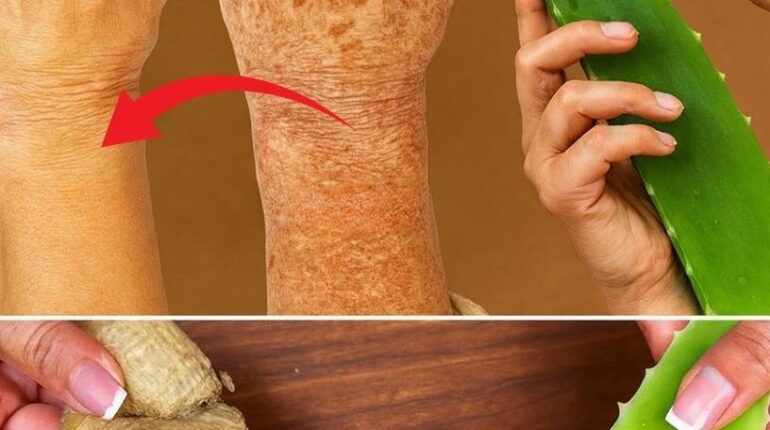 Aloe Vera Collagen Production Ginger Natural Ingredients Radiant Skin Skin Care 