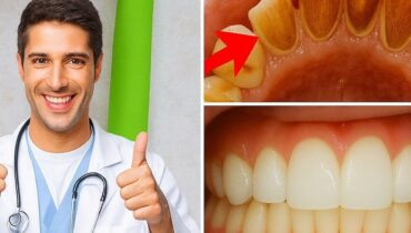 Baking Soda DIY Beauty Home Remedies Natural Ingredients Oral Care Teeth Whitening Turmeric 