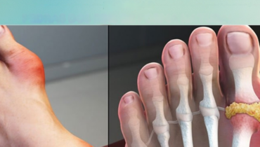 Alfalfa-Tee zur Unterstützung der Nieren: Wie ein 15-Tage-Protokoll bei der Ausgewogenheit der Harnsäure und der Unterstützung der Harnwegsgesundheit helfen kann Alfalfa-Tee zur Unterstützung der Nieren: Wie ein 15-Tage-Protokoll bei der Ausgewogenheit der Harnsäure und der Unterstützung der Harnwegsgesundheit helfen kann