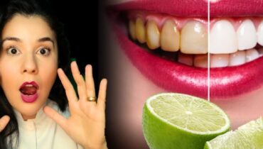 Dental Care Home Remedies Natural Remedies Oral Hygiene Plaque Removal Teeth Whitening 