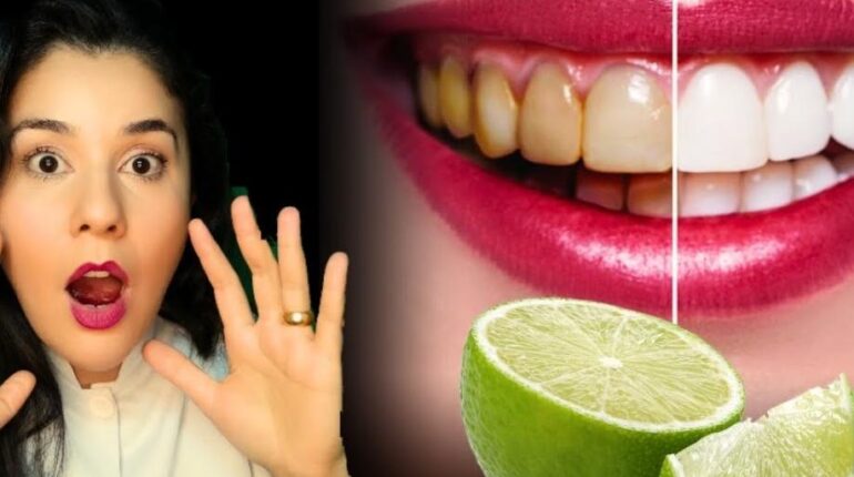Dental Care Home Remedies Natural Remedies Oral Hygiene Plaque Removal Teeth Whitening 