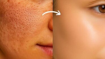 Porzellanhaut: Wie Nelken-Eis Poren verfeinert und Rötungen in unter 3 Minuten reduziert Porzellanhaut: Wie Nelken-Eis Poren verfeinert und Rötungen in unter 3 Minuten reduziert