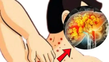 Mit 47 Jahren könnte diese einfache tägliche Gewohnheit Ihre Leber stillschweigend schädigen, ohne dass Sie es wissen Mit 47 Jahren könnte diese einfache tägliche Gewohnheit Ihre Leber stillschweigend schädigen, ohne dass Sie es wissen