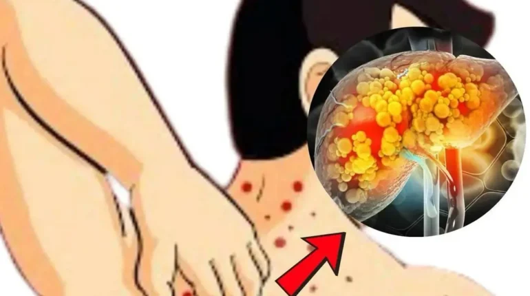 Breathing Exercises Cancer Prevention Diet Fatty Liver Health Habits Lifestyle Liver Health 