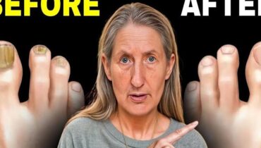 Garlic Home Remedies Nail Health Natural Treatments Salt Toenail Fungus 