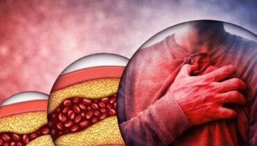 Circulation Detoxification Herbal Remedies Joint Health Metabolism Natural Wellness 