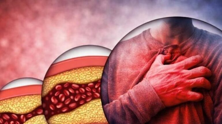 Circulation Detoxification Herbal Remedies Joint Health Metabolism Natural Wellness 