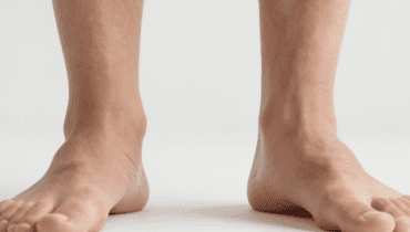 Herzinfarkt: Diese 7 Vorboten erscheinen einen Monat vorher (geschwollene Füße, starke Müdigkeit, Kurzatmigkeit)